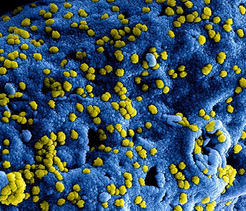 Coronavirus Death Toll Updates