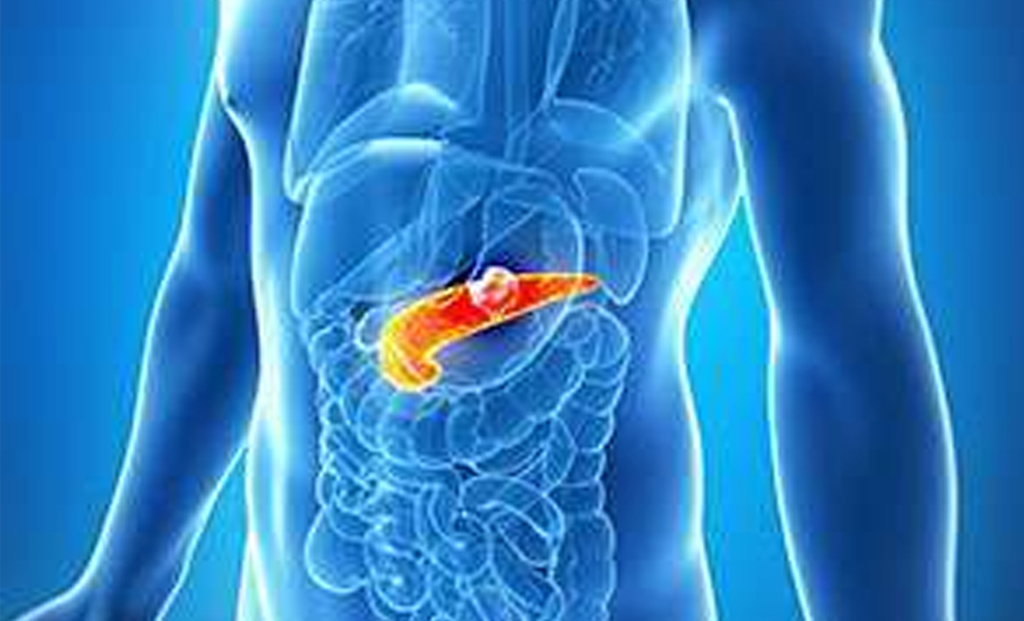 In the case of pancreatic cancer, the tumor is usually formed at the head of the pancreas.