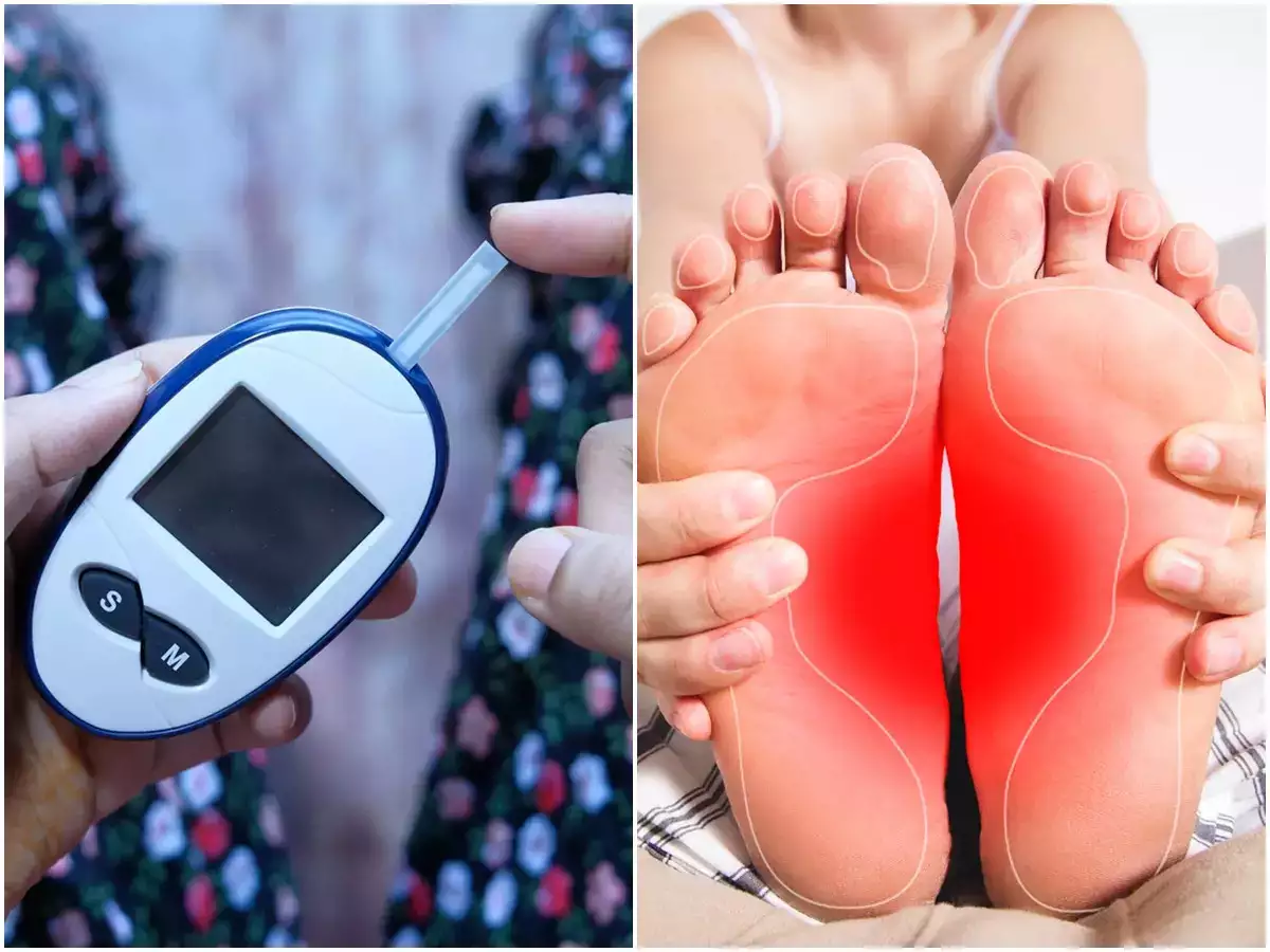 Diabetes Symptoms In Women: Diabetic Foot and 4 Other Warning Signs of High Blood Sugar