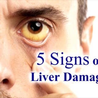 Liver Damage