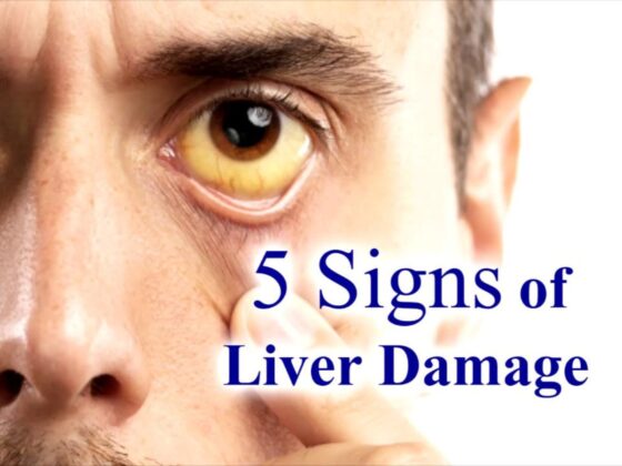 Liver Damage