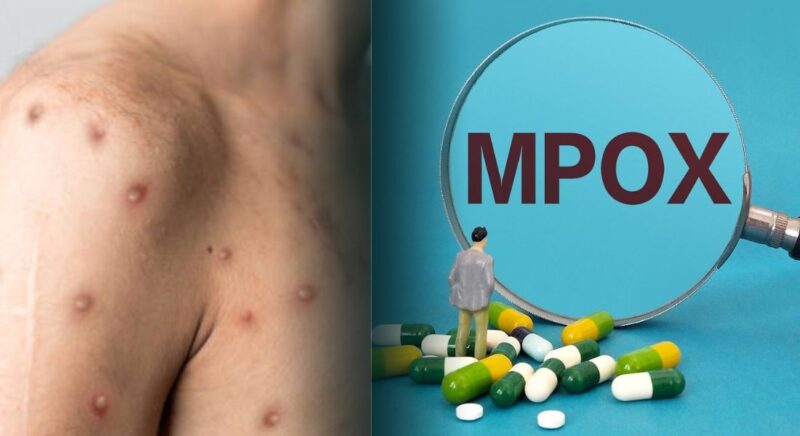 Mpox Health Insurance