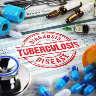 Tuberculosis (TB) Drug