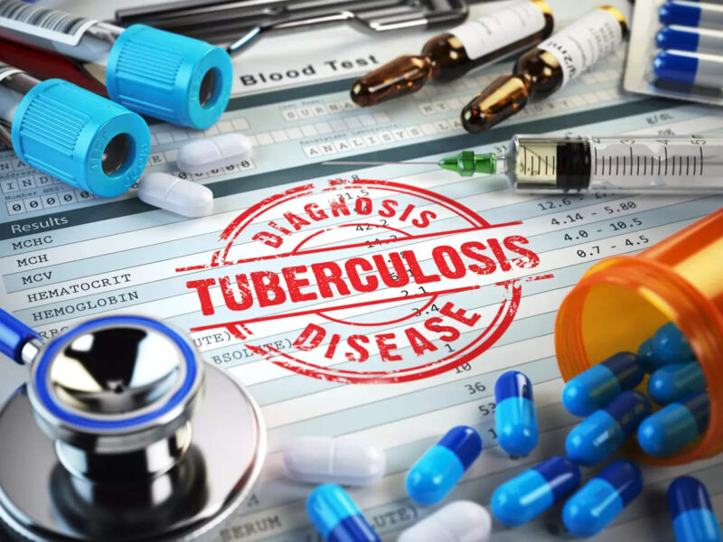 Tuberculosis (TB) Drug