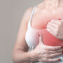 Breast Cancer During Pregnancy