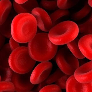 Haemophilia A