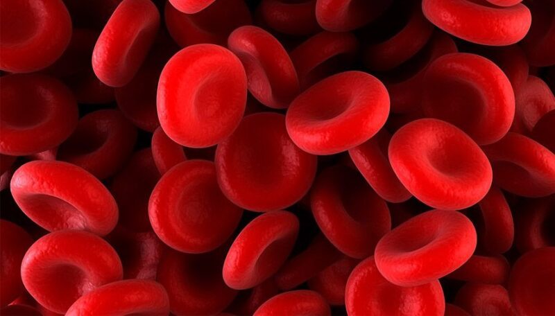 Haemophilia A